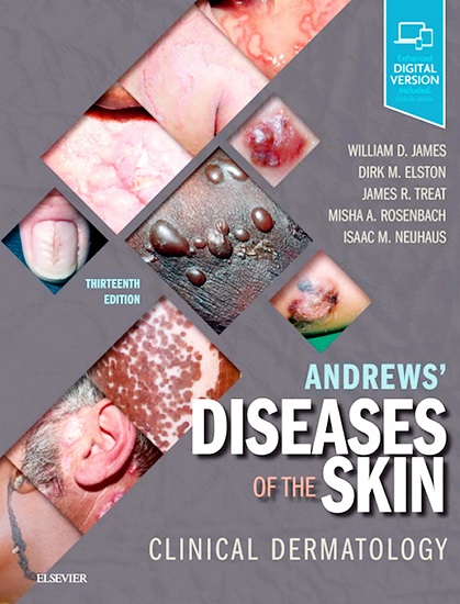 William James. Andrews’ Diseases of the Skin: Clinical Dermatology