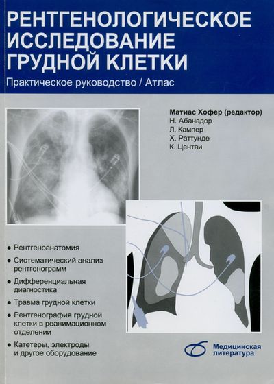 Рентгенологическое исследование