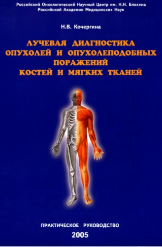 Н.В. Кочергина. Лучевая диагностика опухолей и опухолеподобных поражений костей и мягких тканей