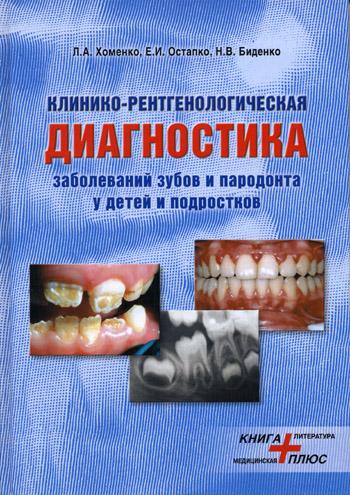 Л.А. Хоменко. Клинико-рентгенологическая диагностика заболеваний зубов и пародонта у детей и подростков